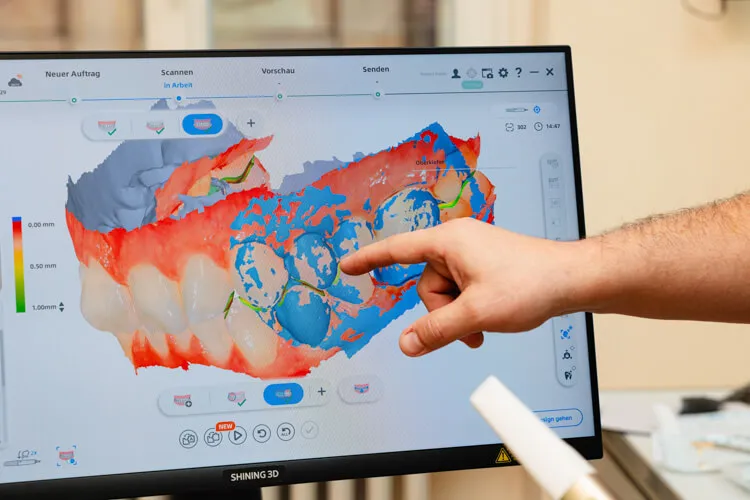 Dr. Balan zeigt etwas an einem Digitalen Zahnscan