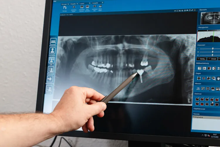Dr. Balan zeigtauf einem Röntgenbild ein Implantat