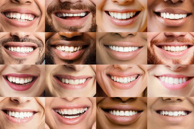 Collage mit verschiedenen Lächelnen Mündern, weißen Zähnen und unterschiedl. Hautfarben