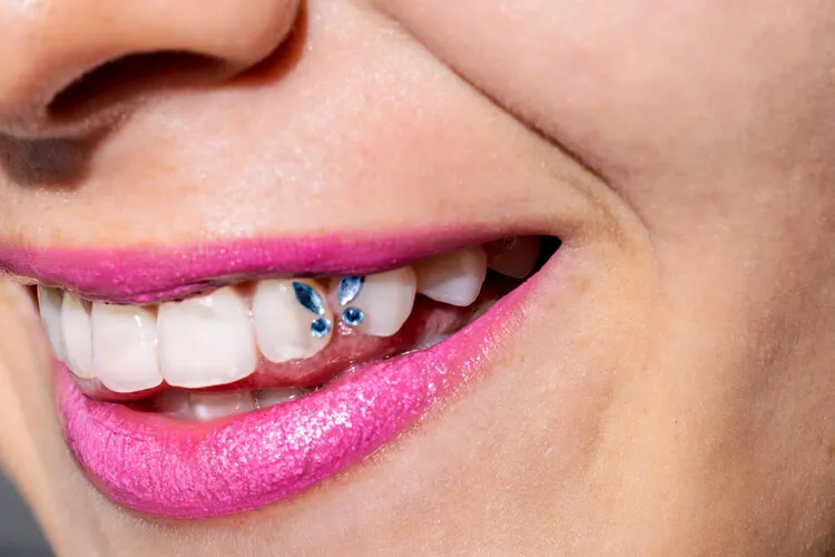 Eine Frau mit einem breiten Lächeln und Zahnschmuck auf ihren Zähnen